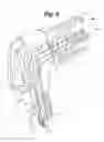 Fig. 07 - SPECULUM COVER AND ASSEMBLY