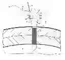 Fig. 01 - Laparoscopic cannula with suturing capability