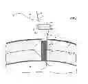 Fig. 02 - Laparoscopic cannula with suturing capability