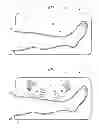 Fig. 02 - Convertible surgical access port