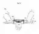 Fig. 210 - Convertible surgical access port