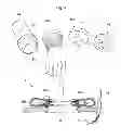 Fig. 22 - Convertible surgical access port