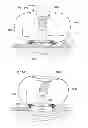 Fig. 261 - Convertible surgical access port