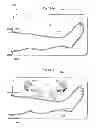 Fig. 293 - Convertible surgical access port