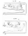 Fig. 294 - Convertible surgical access port