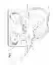 Fig. 32 - Convertible surgical access port