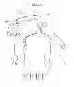 Fig. 341 - Convertible surgical access port