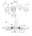 Fig. 372 - Convertible surgical access port
