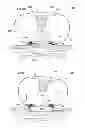 Fig. 46 - Convertible surgical access port