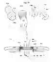 Fig. 50 - Convertible surgical access port