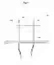 Fig. 52 - Convertible surgical access port