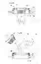 Fig. 67 - Convertible surgical access port