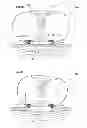 Fig. 71 - Convertible surgical access port