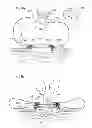 Fig. 72 - Convertible surgical access port