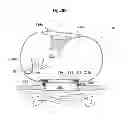 Fig. 74 - Convertible surgical access port