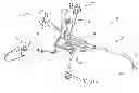 Fig. 01 - METHOD AND SYSTEM FOR REMOTE THYROIDECTOMY AND PARATHYROIDECTOMY