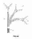 Fig. 06 - METHOD AND SYSTEM FOR REMOTE THYROIDECTOMY AND PARATHYROIDECTOMY