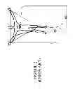 Fig. 03 - Miniature ECG data acquisition device