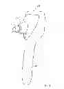 Fig. 08 - Portable Tonometer
