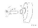 Fig. 09 - Portable Tonometer