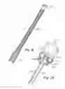 Fig. 10 - IRRIGATED CATHETER