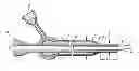 Fig. 01 - MICROCATHETER