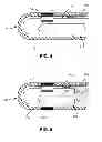 Fig. 04 - ABLATION APPARATUS