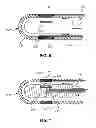Fig. 05 - ABLATION APPARATUS