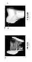 Fig. 28 - 3-D ultrasound imaging device and methods