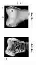 Fig. 30 - 3-D ultrasound imaging device and methods