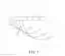 Fig. 02 - Registration Using Phased Array Ultrasound