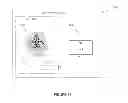 Fig. 15 - METHOD AND SYSTEM FOR DETECTING AND ASSESSING BRAIN INJURIES USING VARIABILITY ANALYSIS OF CEREBRAL BLOOD FLOW VELOCITY
