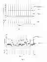Fig. 13 - Circuit for heartbeat detection and beat timing extraction