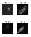 Fig. 12 - IN VIVO DETECTION OF EOSINOPHILS