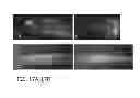 Fig. 15 - IN VIVO DETECTION OF EOSINOPHILS