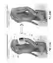 Fig. 22 - Alarm system that processes both motion and vital signs using specific heuristic rules and thresholds