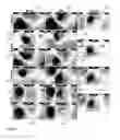Fig. 07 - Computer-aided localization of site of origin of cardiac activation