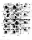 Fig. 09 - Computer-aided localization of site of origin of cardiac activation