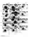 Fig. 10 - Computer-aided localization of site of origin of cardiac activation