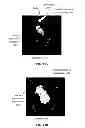 Fig. 15 - AUTOMATED DETERMINATION OF ARTERIAL INPUT FUNCTION AREAS IN PERFUSION ANALYSIS