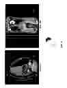 Fig. 23 - AUTOMATED DETERMINATION OF ARTERIAL INPUT FUNCTION AREAS IN PERFUSION ANALYSIS