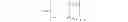 Fig. 03 - PHYSIOLOGICAL INFORMATION MEASUREMENT SYSTEM AND METHOD THEREOF