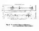 Fig. 46 - Method of processing cardiovascular sound signals
