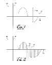 Fig. 02 - Method of detecting reversible nerve injury