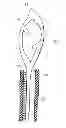 Fig. 01 - Biopsy needle with a laterally expandable distal portion