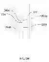 Fig. 22 - Biopsy needle with a laterally expandable distal portion