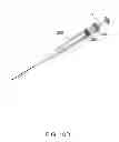 Fig. 30 - Biopsy needle with a laterally expandable distal portion