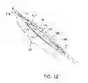 Fig. 34 - Biopsy needle with a laterally expandable distal portion