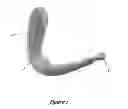 Fig. 02 - PERINEAL MASSAGE DEVICE