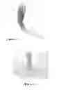 Fig. 08 - PERINEAL MASSAGE DEVICE